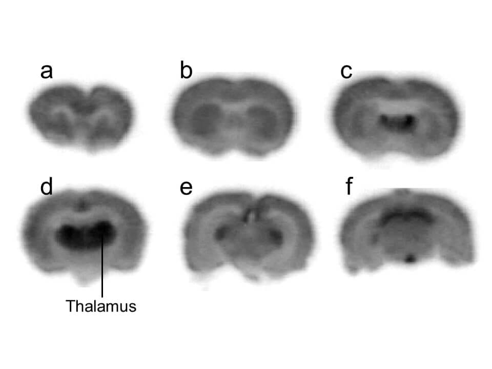 Receptor Autoradiography Services Gifford Bioscience